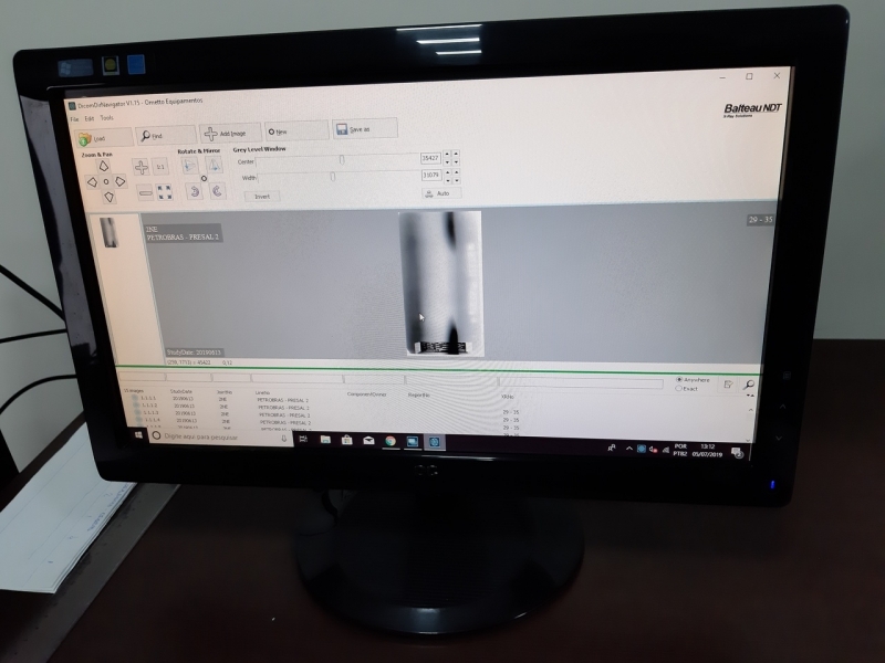 Digitalização de Filmes Radiográficos Odontológicos